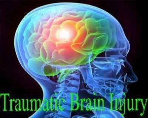 Guidelines for the management of severe traumatic brain injury