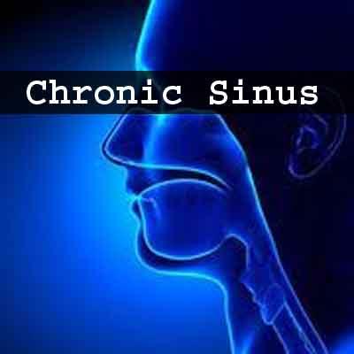 Nasal irrigation may prevent chronic sinus ailments; however, steam inhalation not effective : Study