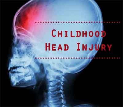 Childhood Head Injury May Up Mental Illness, Mortality Risk, Says Study
