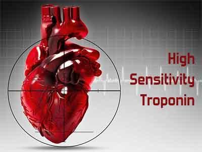 Risk stratification thresholds for high-sensitivity troponin I may speedily rule out MI with accuracy