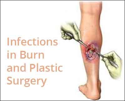 India Antibiotic Guideline For Infections In Burn and Plastic Surgery