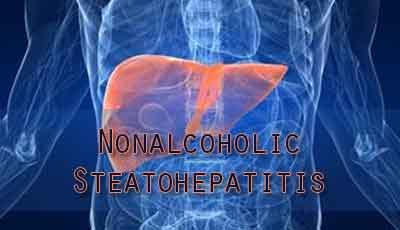 MRI to quantifies liver response in nonalcoholic steatohepatitis patients