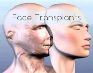 Second face transplant for Frenchman in worlds first