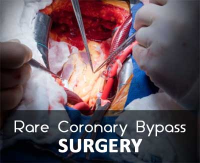 Hyderabad: Coronary bypass surgery on Mesocardio Heart disorder performed by a doctor