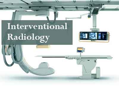 Coimbatore : Rare interventional radiology procedure done