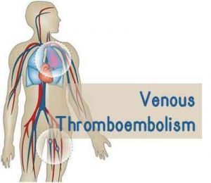 Cesarean Section raises Risk for Postpartum Venous Thromboembolism : CHEST Study