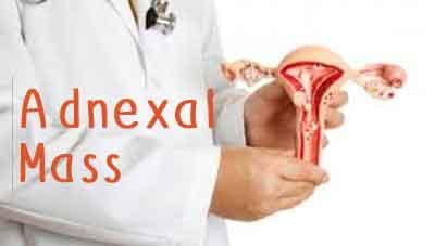 Standard Treatment Guidelines For Adnexal Mass