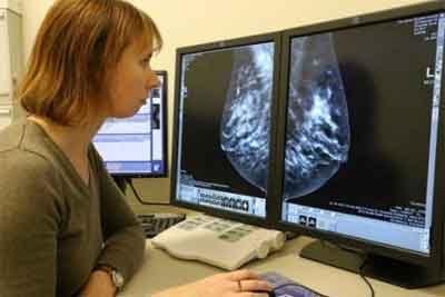 Notify women with dense breasts about increased cancer risk, proposes FDA