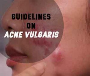 Guidelines of care for the management of acne vulgaris : American Academy of Dermatology