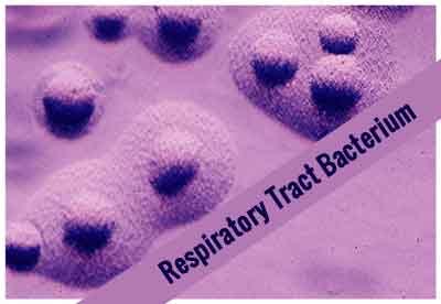 Respiratory tract bacterium uncovered as trigger for serious nervous system disease