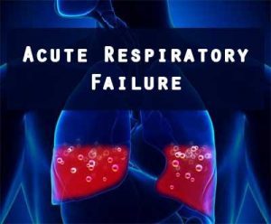 Critical care Guidelines: Acute Respiratory Failure management