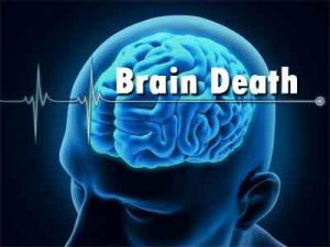 CTP more accurate for diagnosing brain death compared to CTA