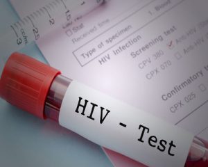 Scientists develop new type of HIV test on a USB stick