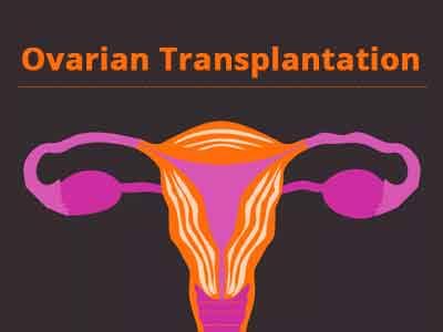 Ovarian transplantation might be possible in future