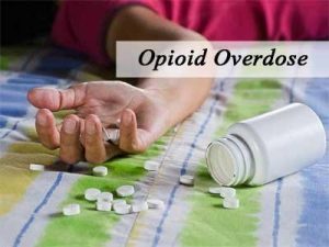 Buprenorphine-naloxone preferred first-line treatment for opioid use disorder -Canadian guidelines