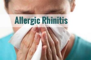 Allergic Rhinitis - Standard Treatment Guidelines