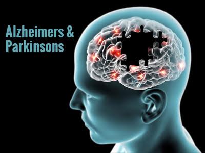 New therapy for Alzheimers and Parkinsons in the offing