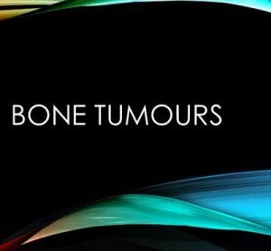 New study demonstrates promising treatment for rare bone disease