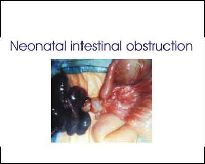 Neonatal intestinal obstruction - Standard Treatment Guidelines