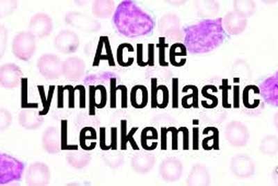 Cancer genomics: Addressing treatment resistance in childhood acute lymphoblastic leukemia