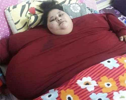 India doctor to operate on 500 kg woman