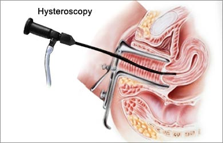 Egypt based doctor performs 28 free of cost uterus surgeries at Nagpur