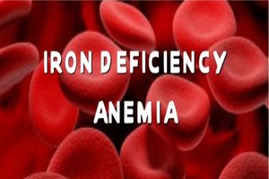 Ferric carboxymaltose safe and effective option for iron deficiency anaemia