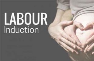 Labor Induction Guidelines by ACOG