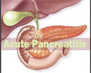 Acute Pancreatitis - Standard Treatment Guidelines