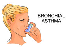 Bronchial Asthma - Standard Treatment Guidelines