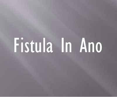 Fistula In Ano - Standard Treatment Guidelines