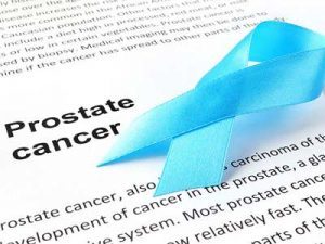 Latest radiation therapy guideline for prostate cancer