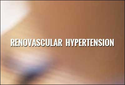 Renovascular Hypertension-Standard Treatment Guidelines