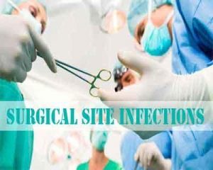 Surgical Site Infection Guidelines- American College of Surgeons and Surgical Infection Society