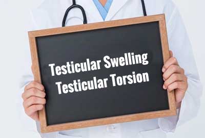 Testicular Swelling-Testicular Torsion-GOI Standard Treatment Guidelines