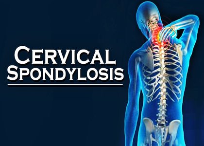 Winter is a cruel season for people with Cervical Spondylitis