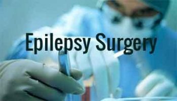 Long-term gains with early epilepsy surgery