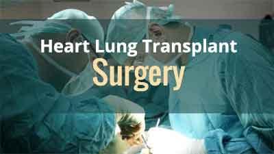 Kochi: Surgeons at Lisie Hospital perform first heart-lung transplant surgery