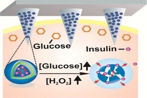Toward a smart patch that automatically delivers insulin when needed