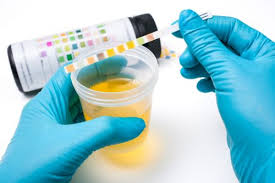 New urine test can quickly detect whether a person has a healthy diet