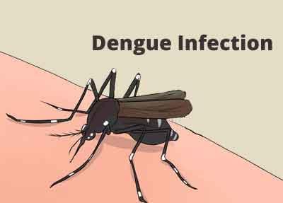 Why only some people develop life-threatening dengue infections