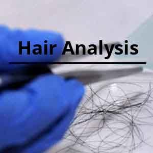 Hair analysis may help diagnose Cushing syndrome, researchers report