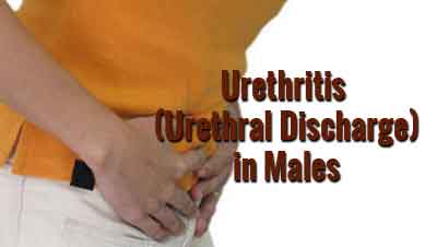 Urethritis-Urethral discharge in males-Standard Treatment Guidelines