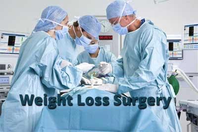 Diabetes patients at higher risk of bariatric surgery-associated complications