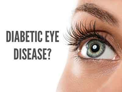 New biomarkers to predict Young Onset of Diabetic Retinopathy: Madras Diabetes Research Foundation Research