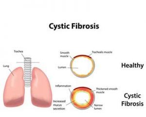 People with cystic fibrosis could be monitored through phone or video messaging, says NICE