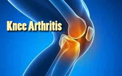 Glucosamine Supplements not effective in Knee or Hip Arthritis Pain :BMJ