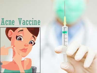 Good News-An acne vaccine is on the horizon