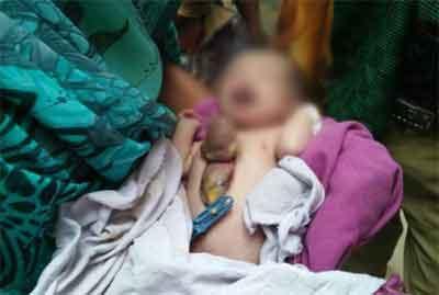 Girl born with heart outside body in MP, shifted to AIIMS