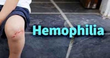 New find offers hope for some Hemophiliacs